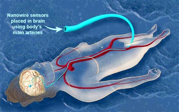 NSF - Wiring the Brain at the Nanoscale