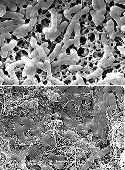 E.coli incubated for one hour on support matrix in the absence (1) or in the presence (2) of nanotubes. (Elimelech/Yale)