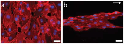 When endothelial progenitor cells are grown on a nanopatterned substrate, they align in the direction of the pattern, left. At right are cells grown on a flat surface. Images / Christopher Bettinger