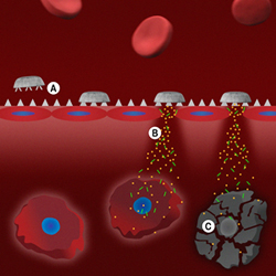 A new multi-stage drug delivery system developed in the laboratory of nanomedicine pioneer Dr. Mauro Ferrari, delivers therapeutic or diagnostic agents directly at the site of a tumor or other problem area. This illustration shows the final stage of the intravenous journey with the arrival of a nanocarrier which is about 100 times smaller than a strand of hair and its payload of anti-cancer medication. (A) shows the injected nanocarrier landing on the inner wall of a tumor-associated blood vessel, (B) the release of nanoparticles that penetrate both the blood vessel wall and the tumor cell membrane and, (C) the delivery to the tumor of doses of a cancer killing medication. Ferrari is testing the system on human tumors in animal models. (Illustration by Matthew Landry)