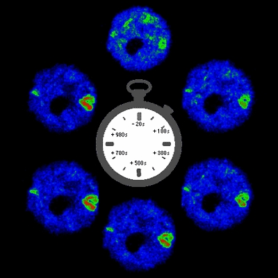 Watching genes turn on: Multiphoton microscopy images of living cells show the transcriptional activation of heat shock loci in real time.
