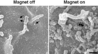 At left, cells were pre-coated with tiny magnetic beads, each binding to a cell receptor (see arrows). When a magnetic field is applied (at right), the beads become magnets and cluster together, pulling the receptors with them. This clustering mimics what happens when drugs or other molecules bind to the receptors, triggering the same biochemical responses in the cell. Image courtesy Don Ingber, PhD, Children's Hospital Boston.