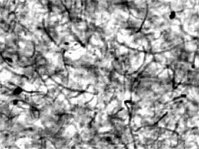 Confocal microscope image of a carbon nanotube/polypropylene composite. Small concentrations of carbon nanotubeshere about one percent by masscan change the electrical properties of the polymer dramatically.

Credit: NIST