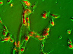 The photo shows the human umbilical matrix stem cells loaded with nanoparticles containing doxorubicin, a widely used chemotherapeutic drug that can damage the heart when given as the free drug.  (Image courtesy of K-State)