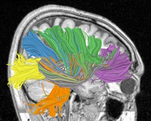 Scientists are studying complex wiring of the brain to build the computer of the future, one that combines the brains abilities for sensation, perception, action, interaction and cognition and its low power consumption and compact size. Understanding the process behind these seemingly effortless feats of the human brain and creating a computational theory based on it remains one of the biggest challenges for computer scientists.

Illustration: D. Modha, IBM