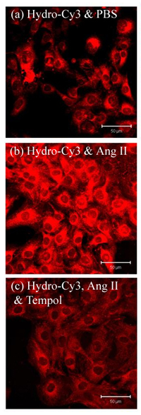 Confocal fluorescent images of rat aortic smooth muscle cells (a) incubated with hydro-Cy3, (b) treated with angiotensin II and incubated with hydro-Cy3, and (c) incubated with angiotensin II and TEMPOL before adding hydro-Cy3. (Courtesy of Kousik Kundu)