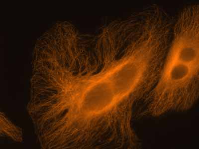 Fixed and permeabilized HeLa cells were labeled with mouse anti-α-tubulin primary antibody and 20nM Qdot 625 goat anti-mouse IgG. Photo: Invitrogen Corporation.   
