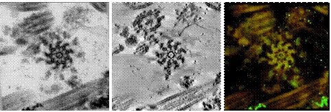 Tomography results from resin-embedded basal bodies. Left to right:  raw, aligned data; reconstruction viewed top to bottom; volume rendering in Chimera.

Data courtesy of Dr. Geimer, Univ. Bayreuth. 
www.zellbiologie.uni-bayreuth.de/researchge.htm