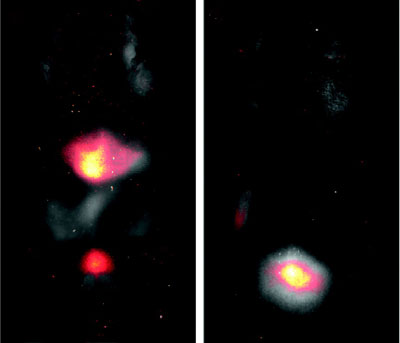 Memorial Sloan Kettering Cancer Center
C dots fluoresce brightly enough to be see through the skin of a mouse (barely visible in these photos). At left, dots accumulated in the liver and bladder 45 minutes after injection. At right, dots coated with polyethylene glycol have all reached the bladder in 45 minutes. These experiments demonstrate that C dots will be harmlessly excreted after they do their job. 