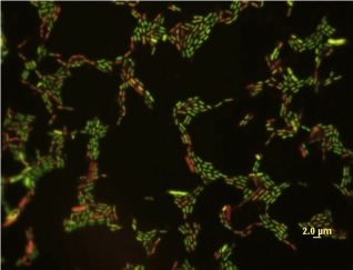 Magnification of E. coli exposed to a low 
concentration (10 mg/L) of titanium dioxide
nanoparticles. Cells with compromised membranes
are stained red.
Credit: University of Toledo