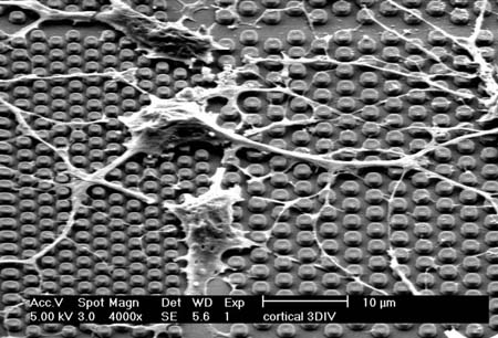 Cortical neurons engulf microscopic nail structures on the surface of IMECs micronail chip (3-day in vitro culture)