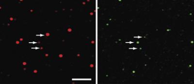 Right: Brain-lipid vesicles. Smaller "dots" indicate smaller vesicles. Left: BAR domain protein. The intensity of the dot indicates the amount of BAR bound to the vesicle. The smaller the vesicle, the more curved membrane, and the more binding of BAR.

Credit: Dimitrios Stamou
