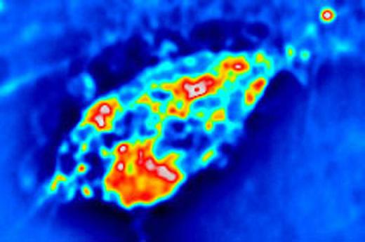 Hippocampal neuron imaged by Spatial Light Interference Microscopy (SLIM) developed at the QLI Lab (light.ece.uiuc.edu/)