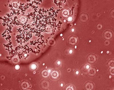 Once E. coli have secreted oil, they sequester themselves from the droplets as shown by this optical image, thereby facilitating oil recovery. (Image by Eric Steen, JBEI)