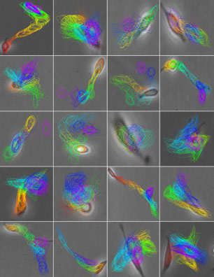 Advanced computer vision technology detects subtle cell movements that are impossible to discern with the human eye.