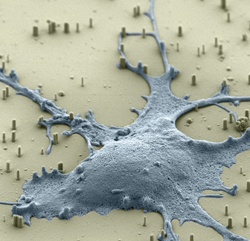 Scanning electron microscope image (false color) of a rat hippocampal neuron on a bed of vertical silicon nanowires. Nanowires penetrate the cell membrane without affecting cell viability, and can be used to efficiently deliver a wide variety of molecules into the cell's cytoplasm.Scanning electron microscope image (false color) of a rat hippocampal neuron on a bed of vertical silicon nanowires. Nanowires penetrate the cell membrane without affecting cell viability, and can be used to efficiently deliver a wide variety of molecules into the cell's cytoplasm. Courtesy: H. Park