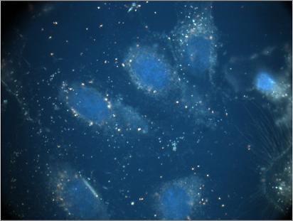 These human bronchial epithelial cells have been transfected with nanoplexes, developed by scientists at UB and CDC, that are uniformly distributed surrounding the cell nuclei. 