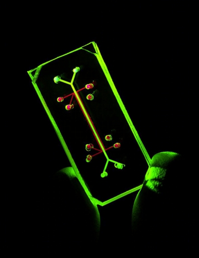 The lung on a chip, shown here, was crafted by combining microfabrication techniques from the computer industry with modern tissue engineering techniques, human cells and a plain old vacuum pump.

Photo courtesy of the Wyss Institute for Biologically Inspired Engineering/Harvard University