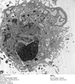 Dark spots are aggregates of gadonanotubes (GNTs) in the cytoplasm of a mesenchymal stem cell. Tests show GNTs are highly effective for tagging and tracking stem cells through magnetic resonance imaging. (Credit: Lesa Tran/Rice University)