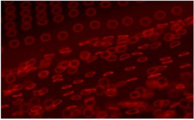 Synthetic red blood cell mimics, shown releasing from an adhesive film into a drop of solvent. The particles were manufactured using PRINT (Particle Replication in Non-wetting Templates) technology, which allows scientists to produce micro- and nanoparticles with customized dimensions and properties. Image courtesy Timothy J. Merkel and Joseph M. DeSimone, University of North Carolina at Chapel Hill.