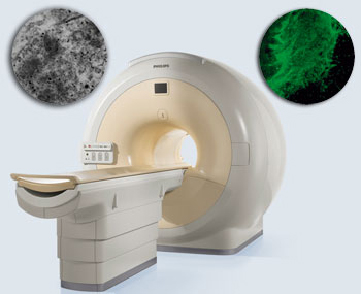 Stem cells attached to biocompatible nanoparticles can be visualised by MRI after transplantation into spinal cord slices.