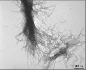 ORNL
Transmission electron microscopy demonstrates the fibrillar nature of huntingtin aggregates.