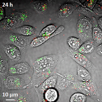 Researchers have demonstrated a new imaging tool for tracking structures called single-wall carbon nanotubes in living cells and the bloodstream, work that could aid efforts to perfect their use in laboratory or medical applications. Here, the imaging system detects both metallic and semiconducting nanotubes, false-colored in red and green, in live hamster cells. (Weldon School of Biomedical Engineering, Purdue University)