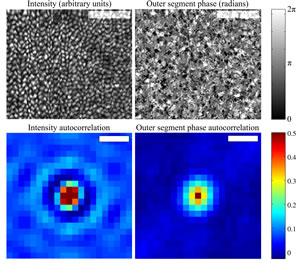 Upper left) En face projection of the cone mosaic, produced by co-adding intensity from the inner segment outer segment junction (ISOS) and outer segment posterior tip (PT) layers, segmented from a single AO-OCT volume. The bright spots correspond to individual cones. Each cone is ~5 μm in diameter. Scale bar 50 μm. 
(Upper right) En face projection of the outer segment referenced phase, created by subtracting the phase at ISOS from the phase at PT. Phase correlation is apparent, at a scale similar to that of the intensity projection. Scale bar 50 μm. 
(Lower left) Autocorrelation of the intensity projection, possessing the stereotypical appearance of a uniformly packed mosaic. The distance between concentric peaks agrees with the predicted cone row spacing. Scale bar 5 μm.
(Lower right) Autocorrelation of the referenced phase projection, lacking the concentric rings observed in the intensity autocorrelation. Scale bar 5 μm. The similarity between autocorrelations' central peaks suggests that both intensity and phase are correlated among pixels within the cone, while the dissimilarity between the tails suggests that periodicity exists in the intensity image but not in the phase image. Credit: Ravi Jonnal, Indiana University.