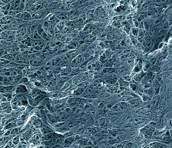Scanning electron microscope image of a typical sample of the NIST single-wall carbon nanotube soot standard reference material. The nanotubes tend to stick together and form smaller and larger bundles. Some of the impurities also are visible. The image shows an area just over a micrometer wide. (Color added for clarity.)
Credit: Vladar, NIST