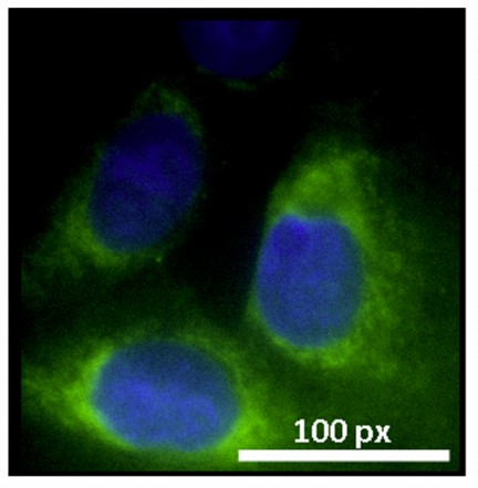 Green-fluorescing graphene quantum dots created at Rice University surround a blue-stained nucleus in a human breast cancer cell. Cells were placed in a solution with the quantum dots for four hours. The dots, each smaller than 5 nanometers, easily passed through the cell membranes, showing their potential value for bioimaging. (Credit: Ajayan Lab/Rice University)