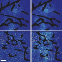 Top panels: control setups. Bottom panels: Mammary tumor tissue after normalization of blood vessels. Left: Few of the large nanoparticles are visible. Right: The smaller nanoparticles have penetrated well. Courtesy of Vikash Chauhan / Nature Nanotech. 