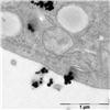 Human lung cells (A549) exposed to hematite nanoparticles (70 nm). Transmission electron micrograph