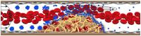 The shear-activated nanotherapeutic breaks apart and releases its drug when it encounters regions of vascular narrowing.

Credit: Wyss Institute