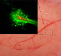 Real-time imaging of a rodent brain shows that nanoparticles coated with polyethylene-glycol (PEG) (green) penetrate farther within the brain than particles without the PEG coating (red).

Credit: Elizabeth Nance, Graeme Woodworth, Kurt Sailor