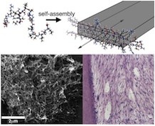 At top, a graphic shows multidomain peptide self-assembling into a nanofiber. The scanning electron microscope image at bottom left shows formed nanofibers; at bottom right, a histological section of cells (blue dots) grows in a dentincylinder, where they mimic the desired dental-pulp regeneration. (Credit: Hartgerink Lab/Rice University)