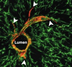 Researchers at MIT and the University of Pennsylvania successfully grew blood vessels within liver tissue grown in the lab. The red circle is a cross-section of the vessel, and endothelial cells (red) sprout from the surface of the tube.
Image courtesy of the researchers/Nature Materials