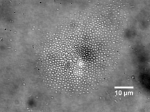 Researchers have demonstrated a new technology that combines a laser and electric fields to create tiny centrifuge-like whirlpools to separate particles and microbes by size, a potential lab-on-a-chip system for medicine and research. Here the technique is used to collect a bacterium called Shewanella oneidensis. (Purdue University image) 