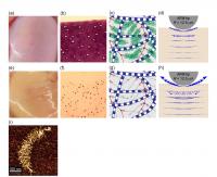 These are images of (a) normal human joint cartilage, and (e) cartilage with very early matrix GAG loss. (b) Histologic image of a normal cartilage stained with Toluidine Blue to visualize content of GAGs. (f) Histologic image of a GAG-depleted cartilage (c) Schematic of extracellular matrix of normal cartilage composed mainly of collagen fibers and aggrecan (g) Schematic of matrix of GAG-depleted cartilage (d,h) Schematic of AFM-based dynamic compression of normal (d) and GAG-depleted (h) cartilage, which results in intra-tissue fluid flow velocity depicted by the blue arrows (from Finite element model computer simulations): loss of GAG (h) enables more fluid to flow out of the cartilage at high loading rates. (i) Human aggrecan imaged by Atomic Force Microscopy (AFM)

Credit: Biophysical Journal, Nia et al.