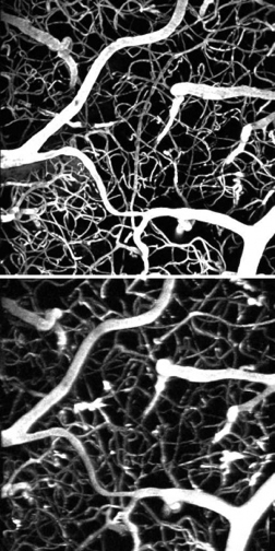 The same section of a mouse brain imaged with a femtosecond laser (above) and a much weaker laser but the new dye (below).