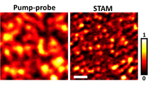 A new type of super-resolution optical microscopy takes a high-resolution image (at right) of graphite "nanoplatelets" about 100 nanometers wide. The imaging system, called saturated transient absorption microscopy, or STAM, uses a trio of laser beams and represents a practical tool for biomedical and nanotechnology research.Weldon School of Biomedical Engineering, Purdue University