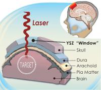 This is an illustrated cross section of the head that shows how the transparent skull implant works.

Credit: Mayo Kodera