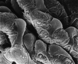 Researchers at Princeton and the University of Michigan have created a computer-based method for separating and identifying genes from diseased kidney cells known as podocytes, pictured above.Image courtesy of Matthias Kretzler