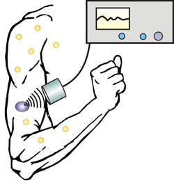 New technique allows diabetics to control insulin release with an injectable nano-network and portable ultrasound device.