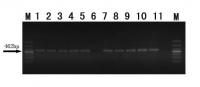 PCR products of methylenetetrahydrofolate reductase C677T DNA samples extracted with magnetic nanoparticles using saliva samples (lanes 1𔃃) and with traditional methods using blood samples (lanes 7󈝷).

Credit: Neural Regeneration Research