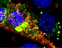 This microscope image shows a cell infected with RSV. The RNA tagged by the probe is shown in red, while the nucleoprotein is green.

Credit: Image courtesy of Eric Alonas and Philip Santangelo