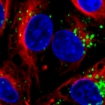  MIT engineers designed nanoparticles that can deliver short strands of RNA (green) into cells (nuclei are stained blue).
Image: Gaurav Sahay, Yizhou Dong, and Omid Veiseh 