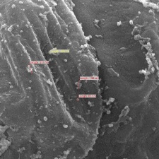 Gagomers (labeled in color) accumulating on ovarian cancer cells