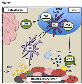 Mechanism of anti-tumor immune resistance induced by local hyperthermia treatment