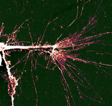 This image shows a PC12 cell growing onto a randomly textures surface. Note how the cell is spreading out in all directions.