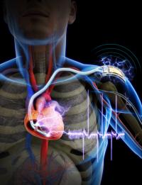 This picture shows that a self-powered cardiac pacemaker is enabled by a flexible piezoelectric energy harvester.

Credit: KAIST